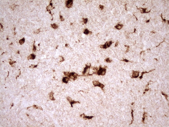 REN Antibody in Immunohistochemistry (Paraffin) (IHC (P))