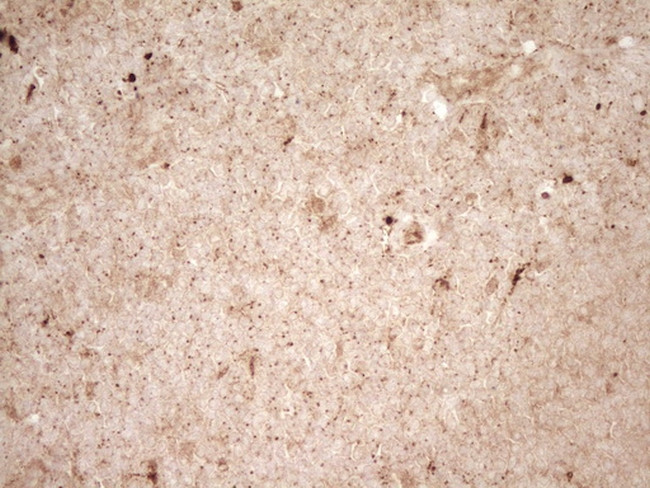 REN Antibody in Immunohistochemistry (Paraffin) (IHC (P))