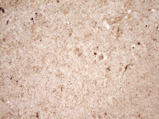 REN Antibody in Immunohistochemistry (Paraffin) (IHC (P))