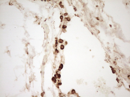 REN Antibody in Immunohistochemistry (Paraffin) (IHC (P))