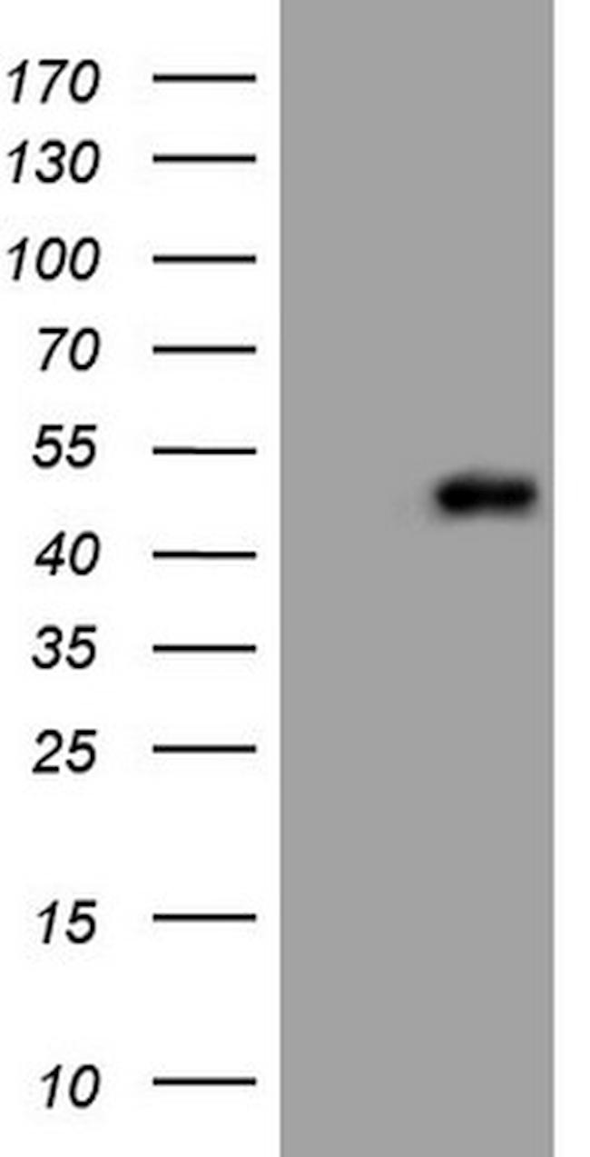 REN Antibody in Western Blot (WB)