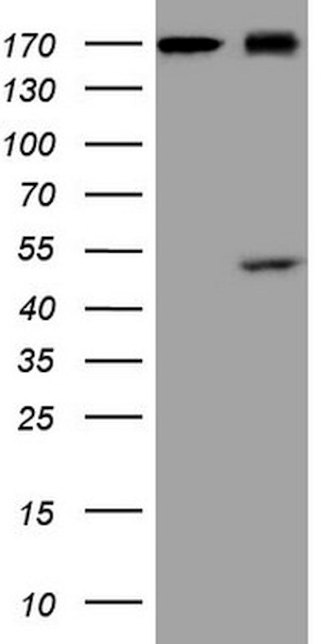 REN Antibody in Western Blot (WB)