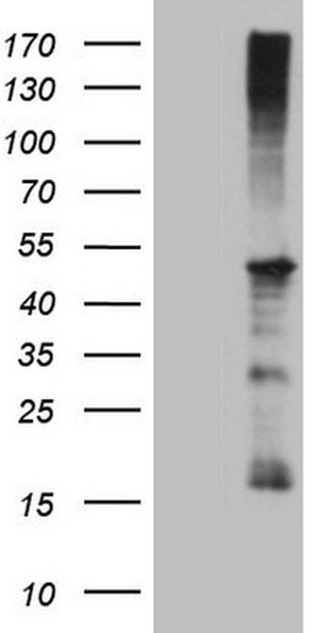 REN Antibody in Western Blot (WB)