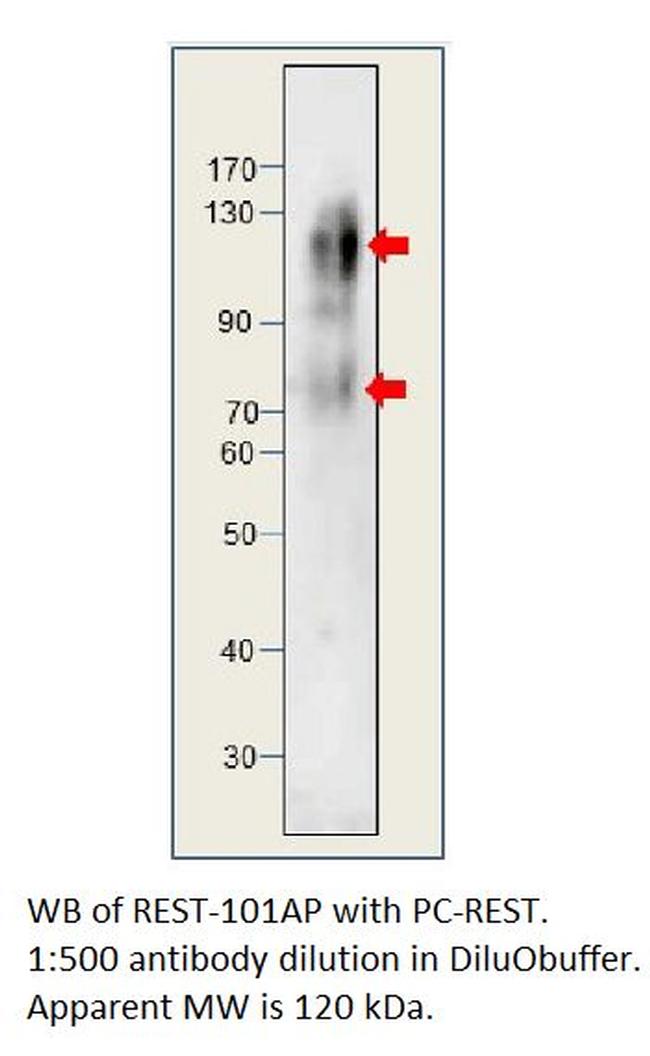 REST/NRSF Antibody in Western Blot (WB)