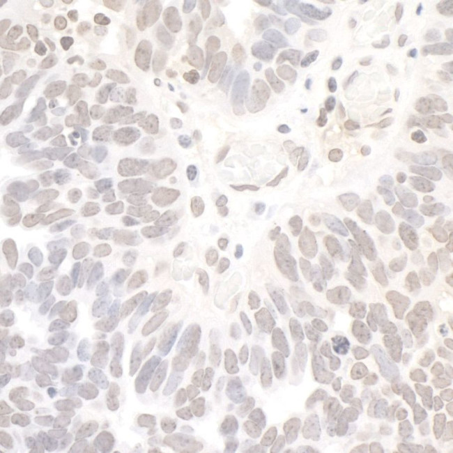 REST Antibody in Immunohistochemistry (IHC)