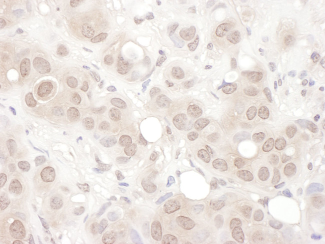 REST Antibody in Immunohistochemistry (IHC)