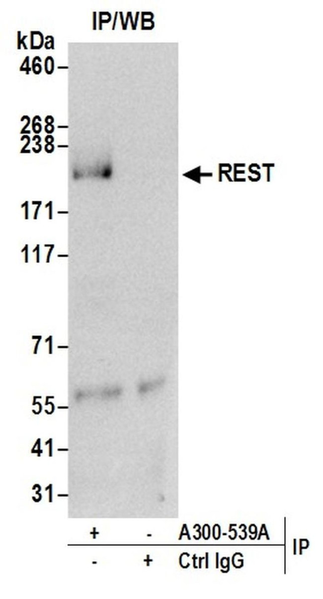 REST Antibody in Immunoprecipitation (IP)