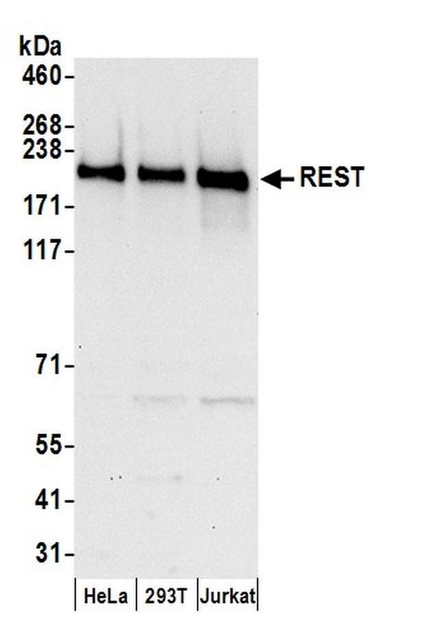 REST Antibody in Western Blot (WB)