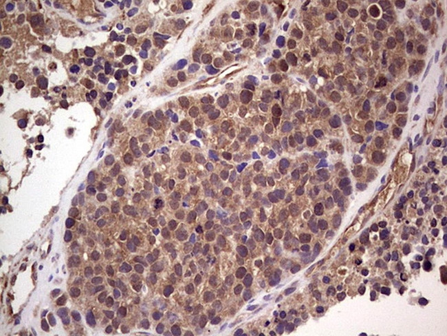 RET Antibody in Immunohistochemistry (Paraffin) (IHC (P))