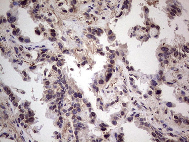 RET Antibody in Immunohistochemistry (Paraffin) (IHC (P))