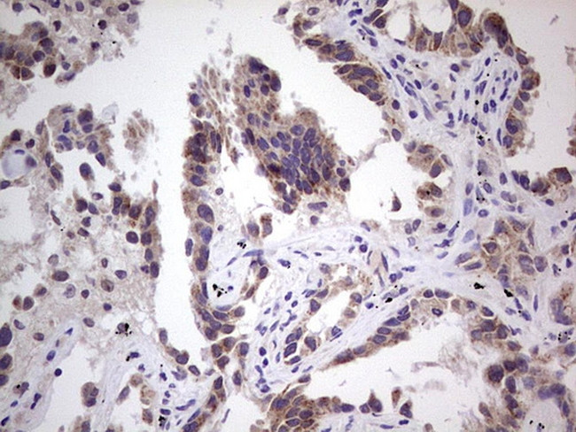 RET Antibody in Immunohistochemistry (Paraffin) (IHC (P))