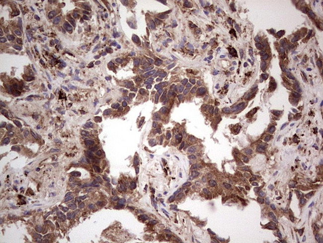 RET Antibody in Immunohistochemistry (Paraffin) (IHC (P))