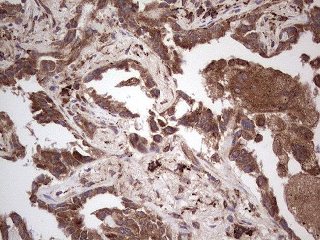 RET Antibody in Immunohistochemistry (Paraffin) (IHC (P))