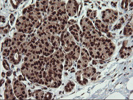 RFC2 Antibody in Immunohistochemistry (Paraffin) (IHC (P))