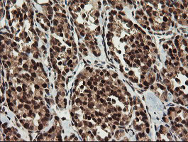 RFC2 Antibody in Immunohistochemistry (Paraffin) (IHC (P))