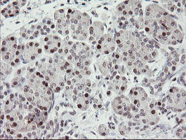 RFC2 Antibody in Immunohistochemistry (Paraffin) (IHC (P))