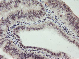 RFC2 Antibody in Immunohistochemistry (Paraffin) (IHC (P))