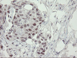 RFC2 Antibody in Immunohistochemistry (Paraffin) (IHC (P))