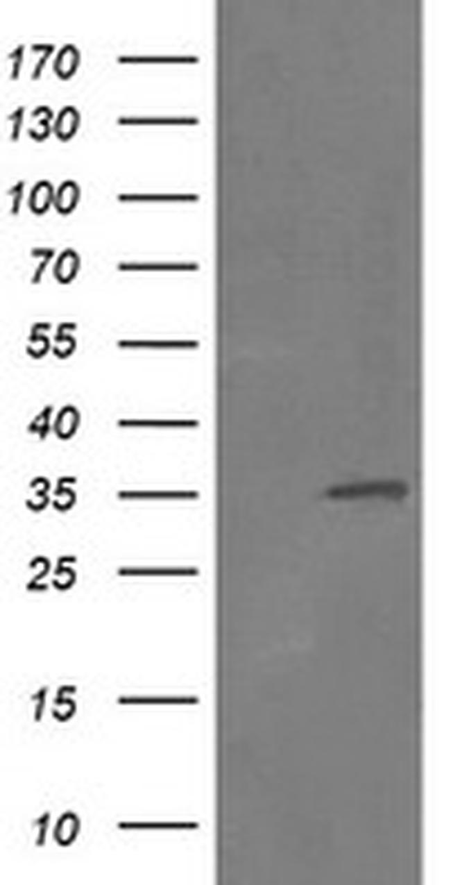 RFC2 Antibody in Western Blot (WB)