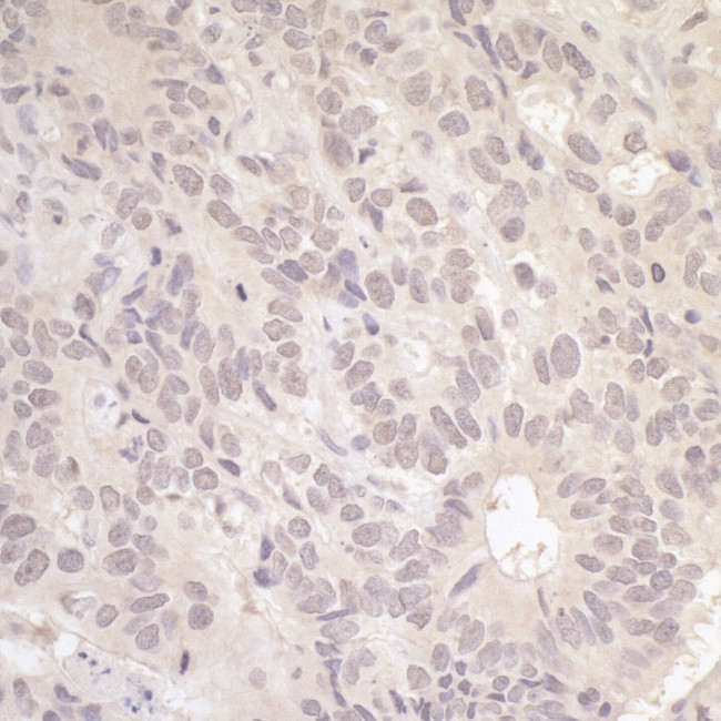 RFC3 Antibody in Immunohistochemistry (IHC)