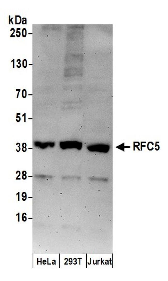 RFC5 Antibody in Western Blot (WB)