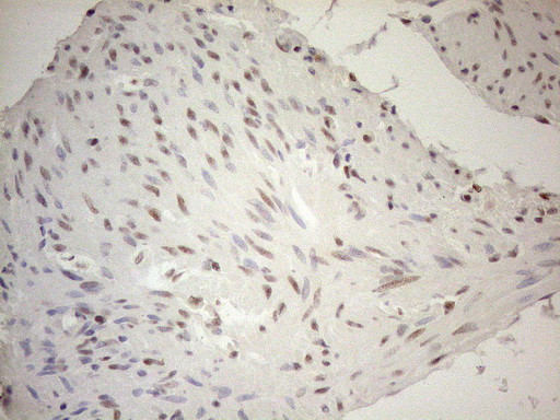 RGL2 Antibody in Immunohistochemistry (Paraffin) (IHC (P))