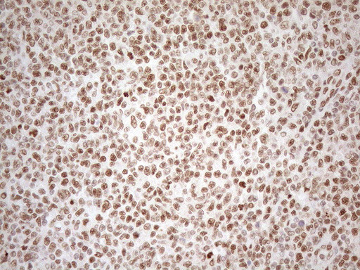 RGL2 Antibody in Immunohistochemistry (Paraffin) (IHC (P))