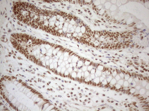 RGL2 Antibody in Immunohistochemistry (Paraffin) (IHC (P))