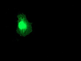 RGS5 Antibody in Immunocytochemistry (ICC/IF)