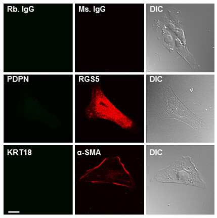 RGS5 Antibody in Immunocytochemistry (ICC/IF)