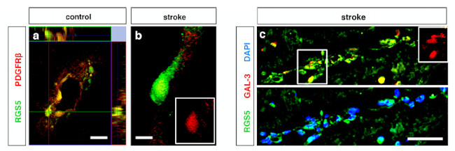 RGS5 Antibody in Immunohistochemistry (IHC)