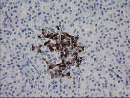 RGS5 Antibody in Immunohistochemistry (Paraffin) (IHC (P))