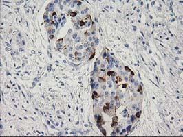 RGS5 Antibody in Immunohistochemistry (Paraffin) (IHC (P))