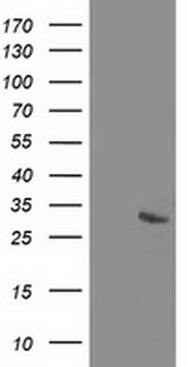 RGS5 Antibody in Western Blot (WB)