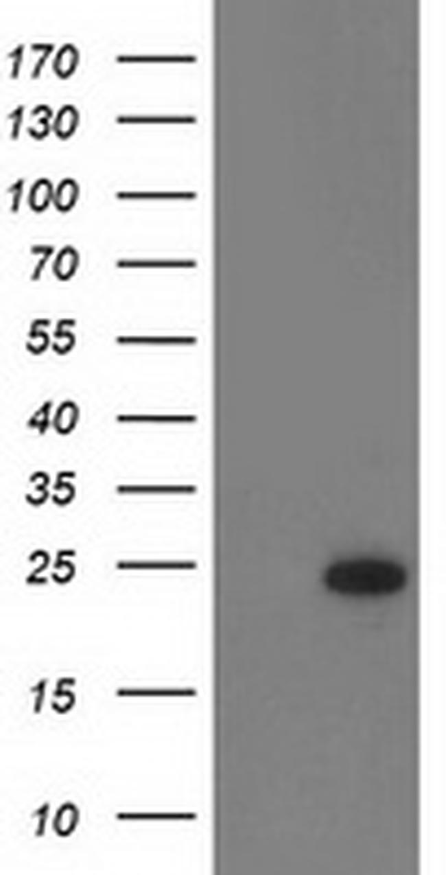 RGS5 Antibody in Western Blot (WB)