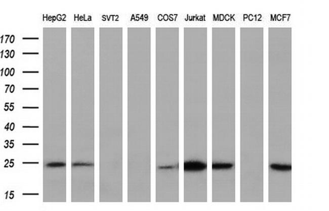 RGS5 Antibody in Western Blot (WB)