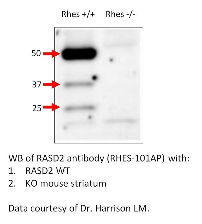 RASD2 Antibody in Western Blot (WB)