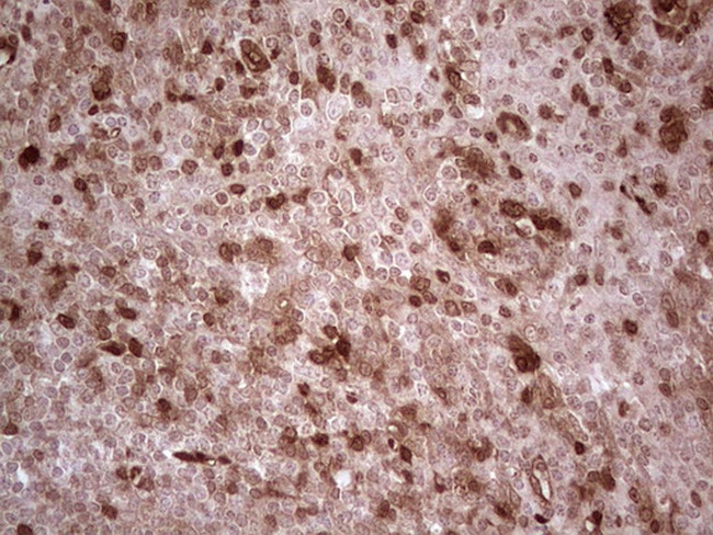 RHOC Antibody in Immunohistochemistry (Paraffin) (IHC (P))