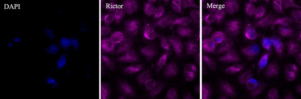 Mouse IgG (H+L) Highly Cross-Adsorbed Secondary Antibody in Immunocytochemistry (ICC/IF)