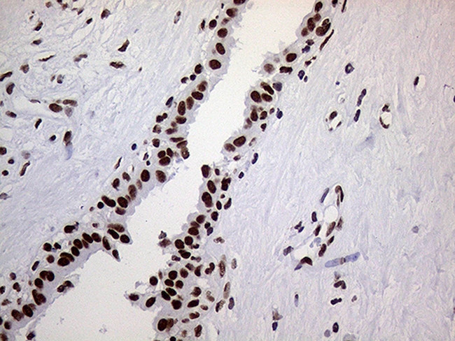 RING1 Antibody in Immunohistochemistry (Paraffin) (IHC (P))