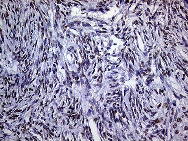 RING1 Antibody in Immunohistochemistry (Paraffin) (IHC (P))