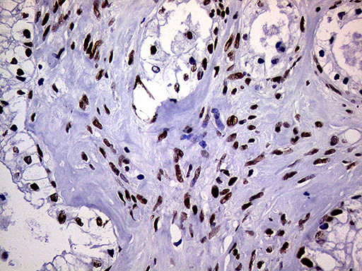 RING1 Antibody in Immunohistochemistry (Paraffin) (IHC (P))