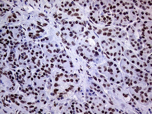 RING1 Antibody in Immunohistochemistry (Paraffin) (IHC (P))