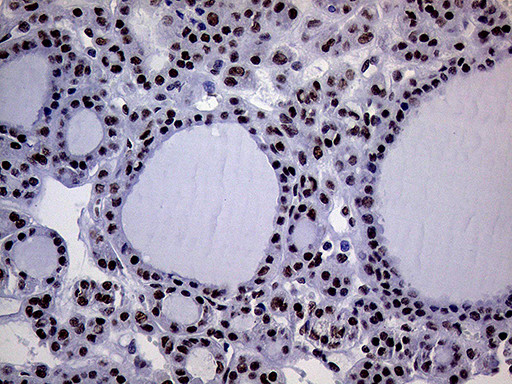 RING1 Antibody in Immunohistochemistry (Paraffin) (IHC (P))