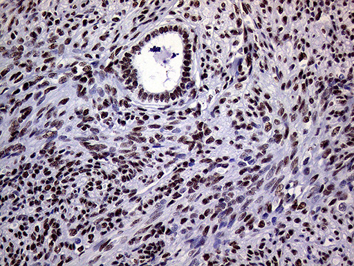 RING1 Antibody in Immunohistochemistry (Paraffin) (IHC (P))