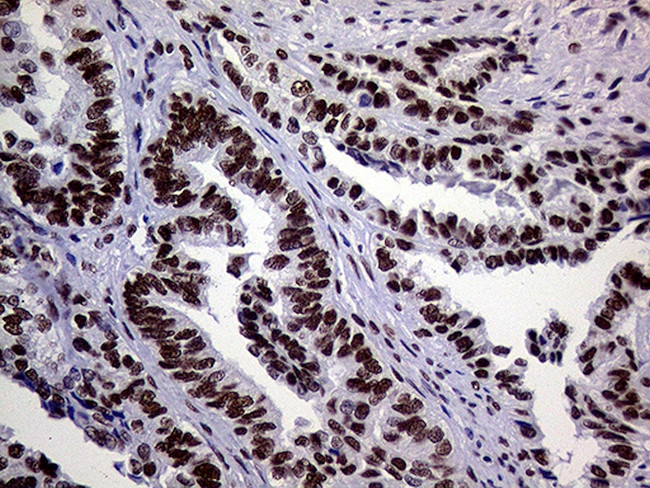 RING1 Antibody in Immunohistochemistry (Paraffin) (IHC (P))