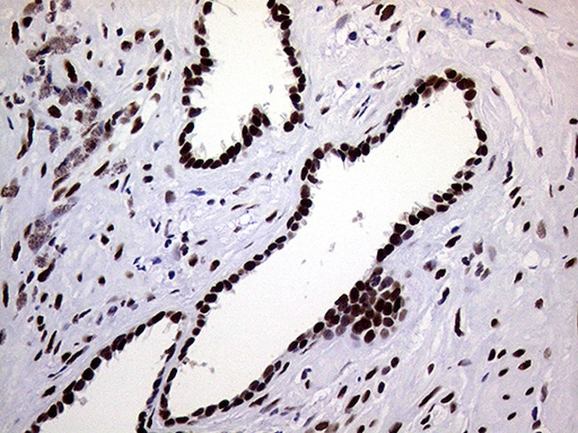 RING1 Antibody in Immunohistochemistry (Paraffin) (IHC (P))