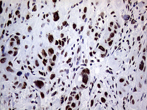 RING1 Antibody in Immunohistochemistry (Paraffin) (IHC (P))