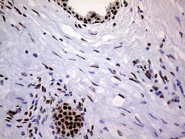 RING1 Antibody in Immunohistochemistry (Paraffin) (IHC (P))