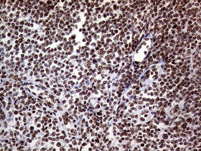 RING1 Antibody in Immunohistochemistry (Paraffin) (IHC (P))